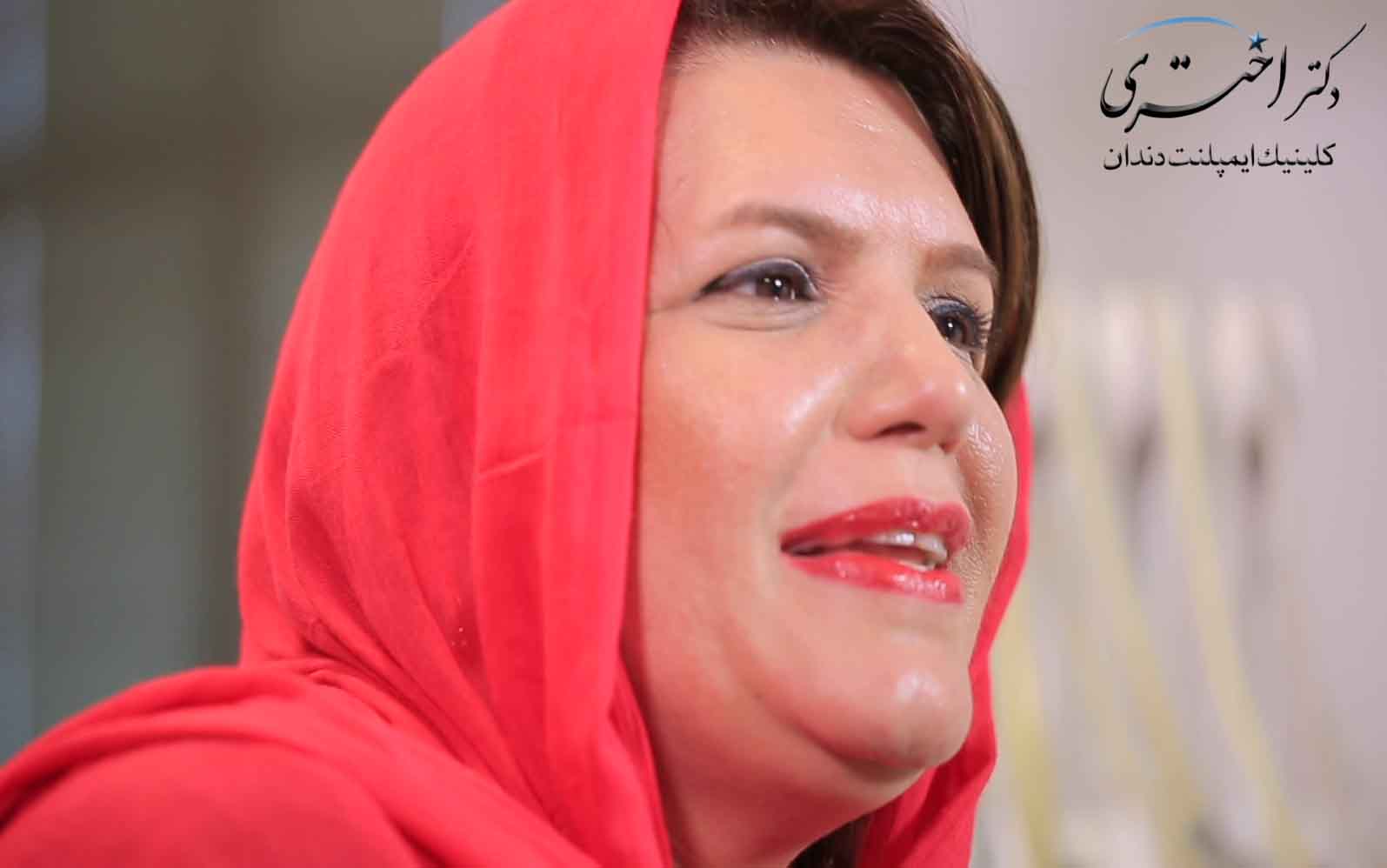 رضایت بیمار از عدم درد پس از جراحی سینوس لیفت باز به همراه ایمپلنت