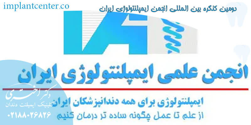 دومین کنگره بین المللی انجمن ایمپلنتولوژی ایران