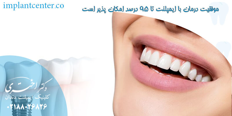 موفقیت درمان با ایمپلنت تا 95 درصد امکان پذیر است