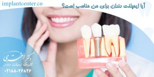 آیا ایمپلنت دندان برای من مناسب است؟