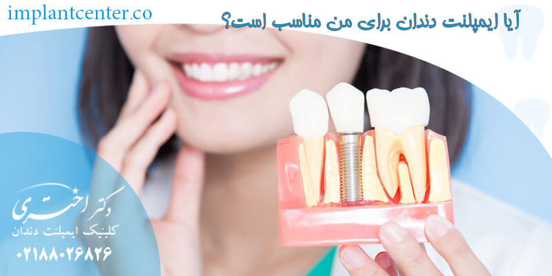 آیا ایمپلنت دندان برای من مناسب است؟