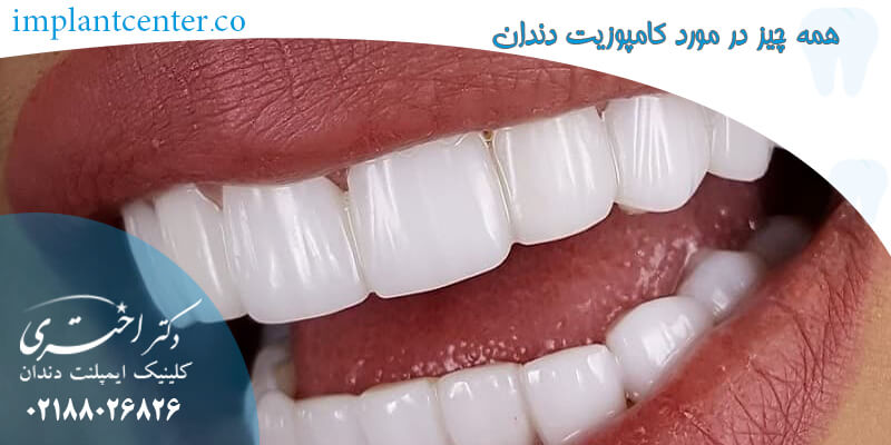 همه چیز در مورد کامپوزیت دندان