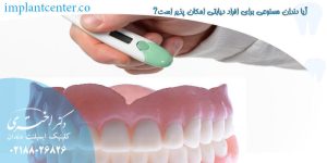 آیا دندان مصنوعی برای افراد دیابتی امکان پذیر است