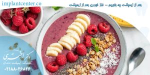 بعد از ایمپلنت چه بخوریم - غذا خوردن بعد از ایمپلنت