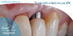 علت آبسه بعد از ایمپلنت چیست و چگونه درمان می شود