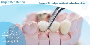 مراحل و روش های قالب گیری ایمپلنت دندان چیست
