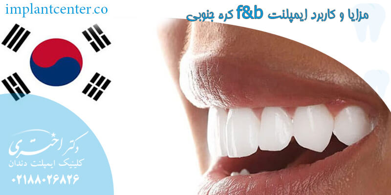 مزایا و کاربرد ایمپلنت f&b کره جنوبی