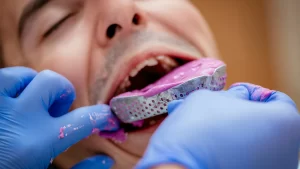 ایمپلنت دندان در بیماران دارای نقص های مادرزادی