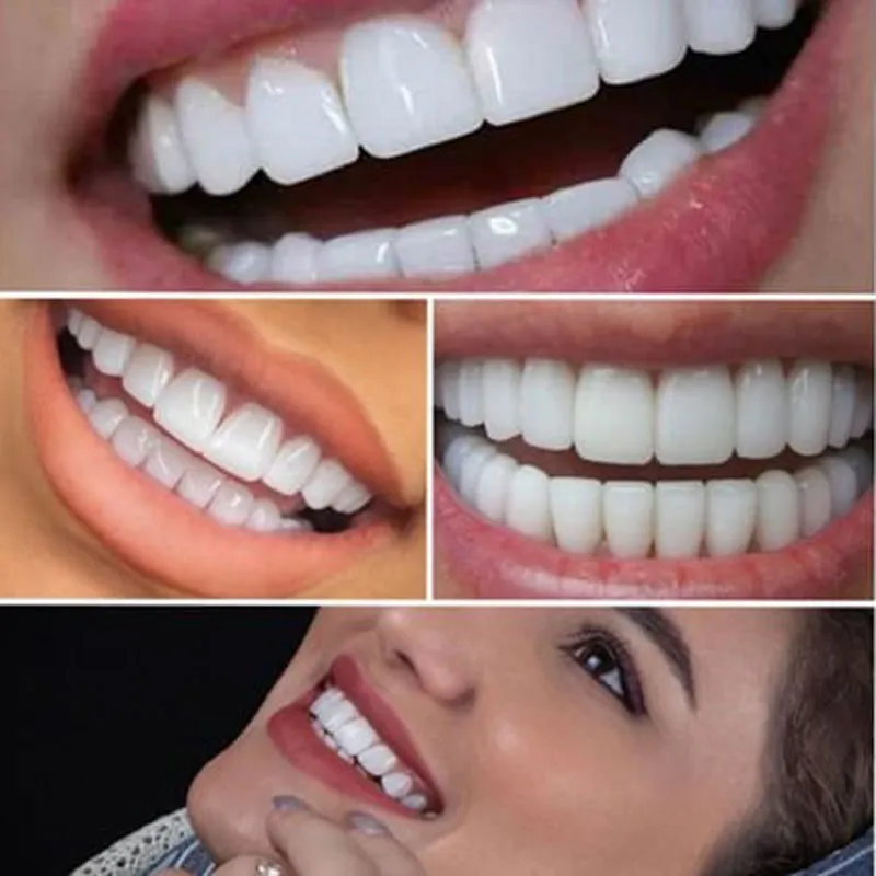 تاثیر رنگ ایمپلنت دندان